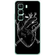 Чохол BoxFace Infinix Hot 50 Pro 