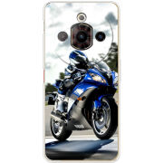 Чохол BoxFace Nubia Focus Pro 5G 