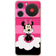 Чохол BoxFace ZTE Nubia Music 