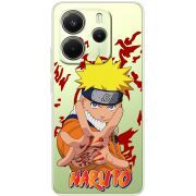 Прозорий чохол BoxFace Xiaomi Redmi Note 14 4G Naruto