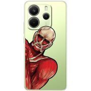 Прозорий чохол BoxFace Xiaomi Redmi Note 14 4G Титан