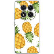 Чохол BoxFace Xiaomi Redmi Note 14 Pro 5G 