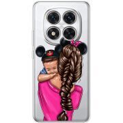 Прозорий чохол BoxFace Xiaomi Redmi Note 14 Pro 5G Mouse Mommy