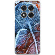 Чохол BoxFace Xiaomi Redmi Note 14 Pro 4G 