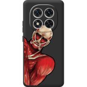 Чорний чохол BoxFace Xiaomi Redmi Note 14 Pro 4G Титан