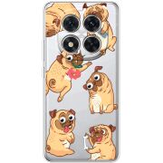 Прозорий чохол BoxFace Xiaomi Redmi Note 14 Pro Plus 5G с 3D-глазками Pug