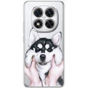 Прозорий чохол BoxFace Xiaomi Redmi Note 14 Pro Plus 5G Husky