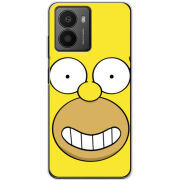 Чохол BoxFace HMD Fusion 