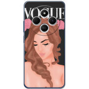 Чохол BoxFace Xiaomi Redmi A4 Fashion Girl