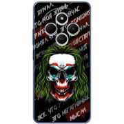 Чохол BoxFace Xiaomi Redmi A4 