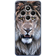 Чохол BoxFace Xiaomi Redmi A4 