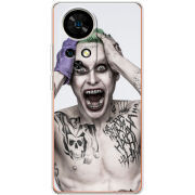 Чохол BoxFace Ulefone Note 17 Pro 
