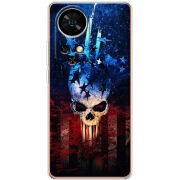 Чохол BoxFace Ulefone Note 17 Pro 
