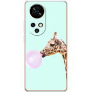 Чохол BoxFace Ulefone Note 17 Pro 
