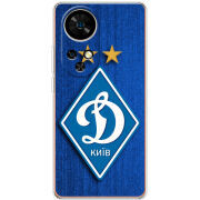Чохол BoxFace Ulefone Note 17 Pro Динамо Киев