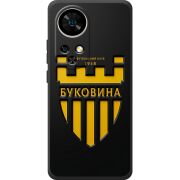 Чорний чохол BoxFace Ulefone Note 17 Pro 