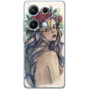 Чохол BoxFace Xiaomi Redmi Note 14S 