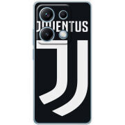 Чохол BoxFace Xiaomi Redmi Note 14S FC J