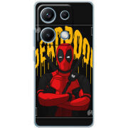 Чохол BoxFace Xiaomi Redmi Note 14S 