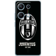 Чохол BoxFace Xiaomi Redmi Note 14S 