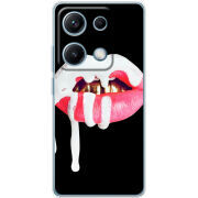 Чохол BoxFace Xiaomi Redmi Note 14S 