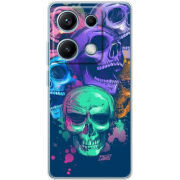 Чохол BoxFace Xiaomi Redmi Note 14S 