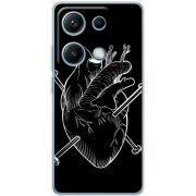 Чохол BoxFace Xiaomi Redmi Note 14S 