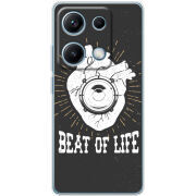 Чохол BoxFace Xiaomi Redmi Note 14S 