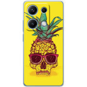 Чохол BoxFace Xiaomi Redmi Note 14S Pineapple Skull