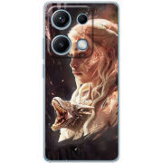 Чохол BoxFace Xiaomi Redmi Note 14S 