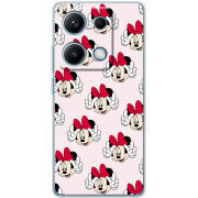 Чохол BoxFace Xiaomi Redmi Note 14S 