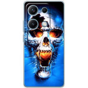 Чохол BoxFace Xiaomi Redmi Note 14S 