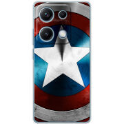 Чохол BoxFace Xiaomi Redmi Note 14S 