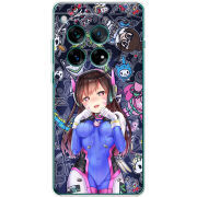 Чохол BoxFace OnePlus 12 Overwatch D.VA