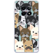 Чохол BoxFace Realme 12 5G 