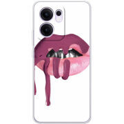 Чохол BoxFace OPPO Reno 13 F 