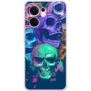 Чохол BoxFace OPPO Reno 13 F 