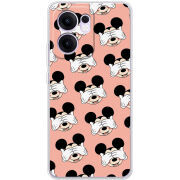 Чохол BoxFace OPPO Reno 13 F 