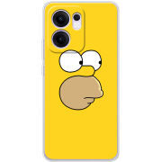 Чохол BoxFace OPPO Reno 13 F 