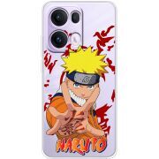 Прозорий чохол BoxFace OPPO Reno 13 Pro 5G Naruto