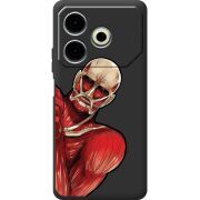 Черный чехол BoxFace Tecno POVA 6 Neo Титан