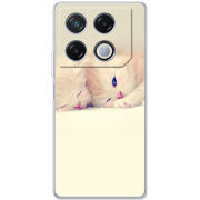Чехол BoxFace Infinix GT 20 Pro 
