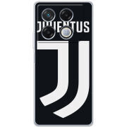 Чехол BoxFace Infinix GT 20 Pro FC J