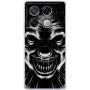 Чехол BoxFace Infinix GT 20 Pro 