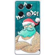 Чехол BoxFace Infinix GT 20 Pro 