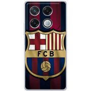 Чехол BoxFace Infinix GT 20 Pro 