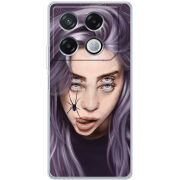 Чехол BoxFace Infinix GT 20 Pro 