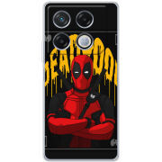 Чехол BoxFace Infinix GT 20 Pro 