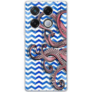 Чехол BoxFace Infinix GT 20 Pro Sea Tentacles