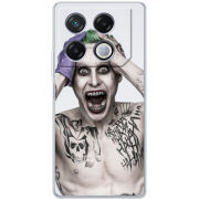 Чехол BoxFace Infinix GT 20 Pro 